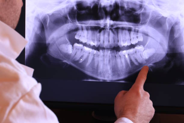 Best Emergency Dentist for Lost Fillings or Crowns in Louisville, CO